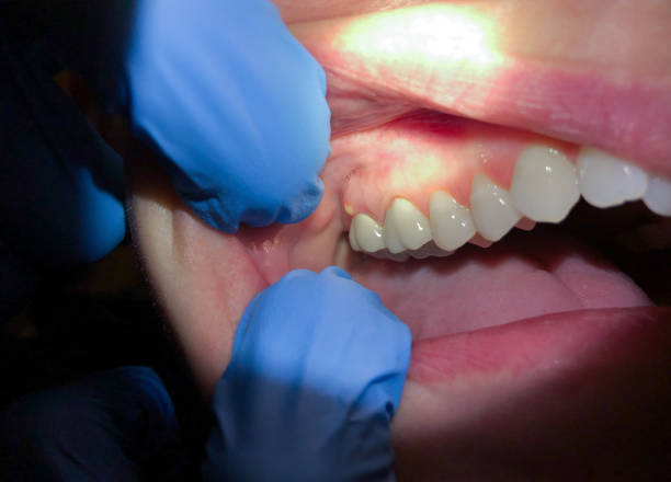 Best Emergency Dental Services for Seniors in Virginia Beach, VA